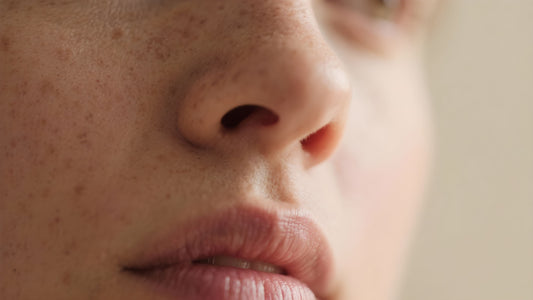 Sebaceous Filaments â Hva er de og hvordan bli kvitt dem