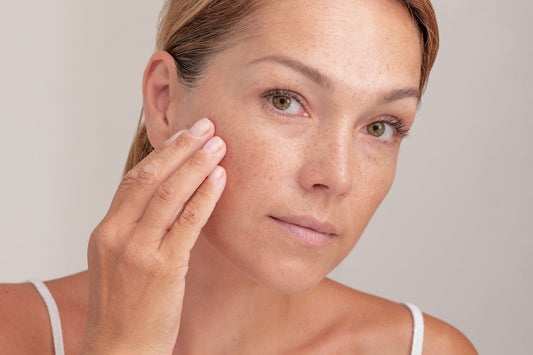 Sebaceous Filaments vs. Blackheads
